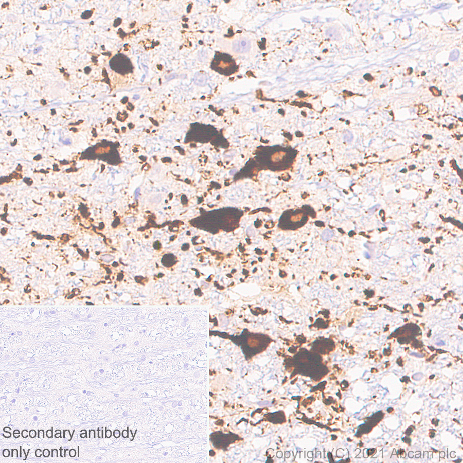 Immunohistochemistry (Formalin/PFA-fixed paraffin-embedded sections) - Anti-TPH2 antibody [EPR25100-29] (AB288067), expandable thumbnail