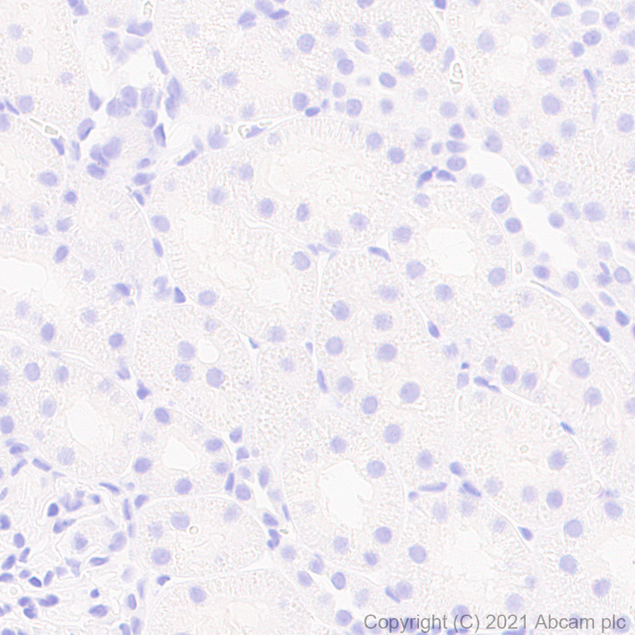Immunohistochemistry (Formalin/PFA-fixed paraffin-embedded sections) - Anti-TPH2 antibody [EPR25100-29] (ab288067), expandable thumbnail