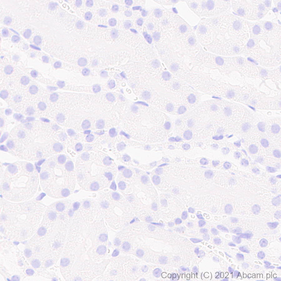 Immunohistochemistry (Formalin/PFA-fixed paraffin-embedded sections) - Anti-TPH2 antibody [EPR25100-29] (ab288067), expandable thumbnail