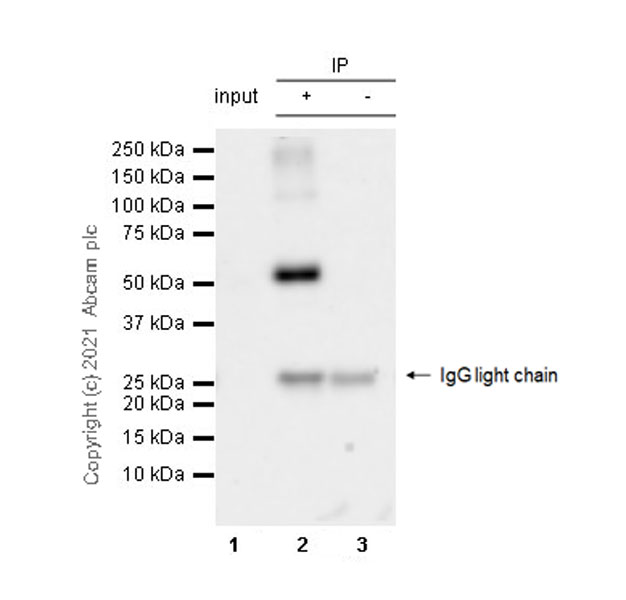 Immunoprecipitation - Anti-TPH2 antibody [EPR25100-29] (AB288067), expandable thumbnail