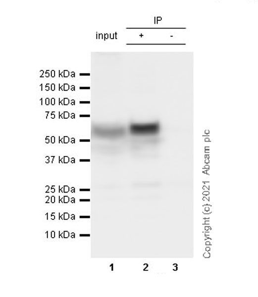 Immunoprecipitation - Anti-TPH2 antibody [EPR25100-29] (ab288067), expandable thumbnail