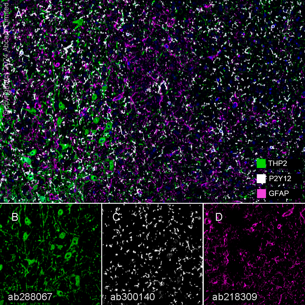 Multiplex immunohistochemistry - Anti-TPH2 antibody [EPR25100-29] (ab288067), expandable thumbnail