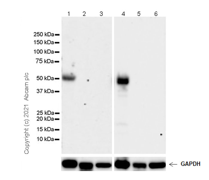 Western blot - Anti-TPH2 antibody [EPR25100-29] (ab288067), expandable thumbnail