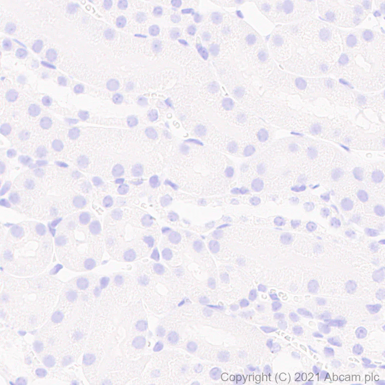 Immunohistochemistry (Formalin/PFA-fixed paraffin-embedded sections) - Anti-TPH2 antibody [EPR25100-29] - BSA and Azide free (AB288068)