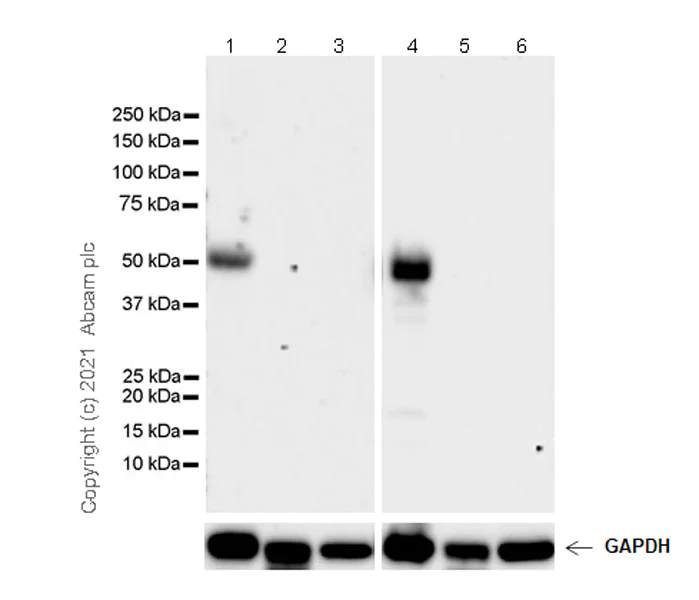 Western blot - Anti-TPH2 antibody [EPR25100-29] - BSA and Azide free (AB288068)