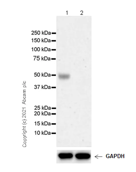 Western blot - Anti-TPH2 antibody [EPR25100-29] - BSA and Azide free (AB288068)