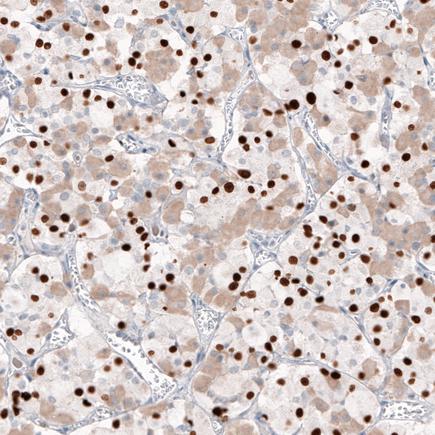 Immunohistochemistry (Formalin/PFA-fixed paraffin-embedded sections) - Anti-Tpit antibody [CL6251] (AB243028), expandable thumbnail