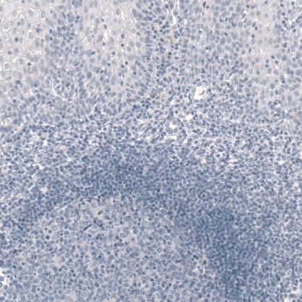 Immunohistochemistry (Formalin/PFA-fixed paraffin-embedded sections) - Anti-Tpit antibody [CL6251] (AB243028), expandable thumbnail