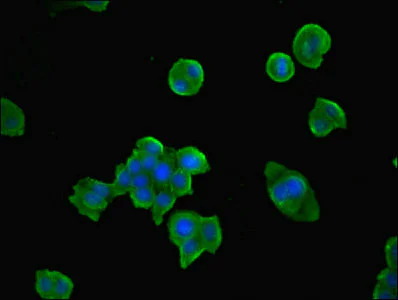 Immunocytochemistry/ Immunofluorescence - Anti-TPK1 antibody (AB230263)
