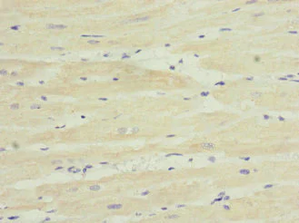 Immunohistochemistry (Formalin/PFA-fixed paraffin-embedded sections) - Anti-TPK1 antibody (AB230263)