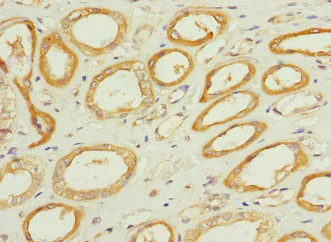 Immunohistochemistry (Formalin/PFA-fixed paraffin-embedded sections) - Anti-TPK1 antibody (AB230263)