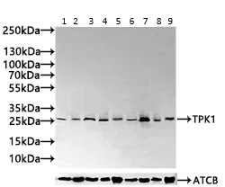 Western blot - Anti-TPK1 antibody (AB230263)