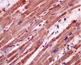 Immunohistochemistry (Formalin/PFA-fixed paraffin-embedded sections) - Anti-TPM4 antibody [EPR13316] (AB181085)