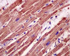 Immunohistochemistry (Formalin/PFA-fixed paraffin-embedded sections) - Anti-TPM4 antibody [EPR13316] (AB181085)