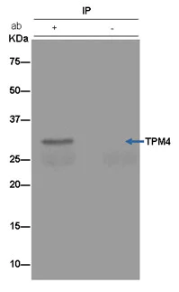 Immunoprecipitation - Anti-TPM4 antibody [EPR13316] (AB181085)