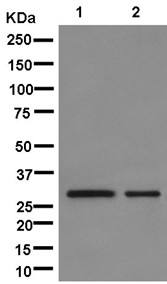 Western blot - Anti-TPM4 antibody [EPR13316] (AB181085)