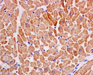 Immunohistochemistry (Formalin/PFA-fixed paraffin-embedded sections) - Anti-TPM4 antibody [EPR13317] (AB181156), expandable thumbnail