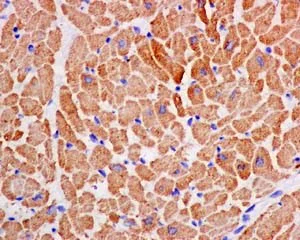 Immunohistochemistry (Formalin/PFA-fixed paraffin-embedded sections) - Anti-TPM4 antibody [EPR13317] (AB181156)