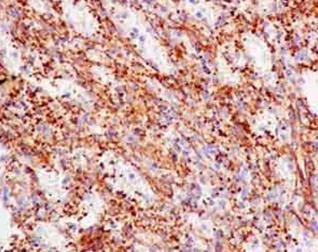 Immunohistochemistry (Formalin/PFA-fixed paraffin-embedded sections) - Anti-TPM4 antibody [EPR13317] (AB181156)