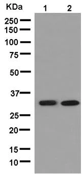 Western blot - Anti-TPM4 antibody [EPR13317] (AB181156)