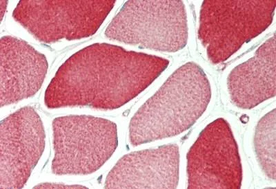 Immunohistochemistry (Formalin/PFA-fixed paraffin-embedded sections) - Anti-TPM4 antibody - N-terminal (AB230880)