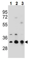 Western blot - Anti-TPM4 antibody - N-terminal (AB230880)