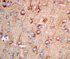 Immunohistochemistry (Formalin/PFA-fixed paraffin-embedded sections) - Anti-TPMT antibody [EPR10820(B)] (AB155284)