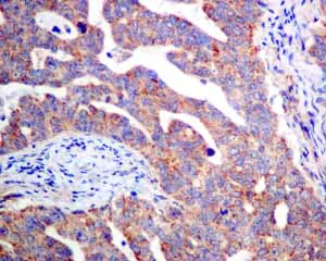 Immunohistochemistry (Formalin/PFA-fixed paraffin-embedded sections) - Anti-TPMT antibody [EPR10820(B)] (AB155284)