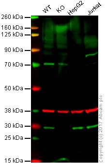 Western blot - Anti-TPMT antibody [EPR10820(B)] (AB155284)