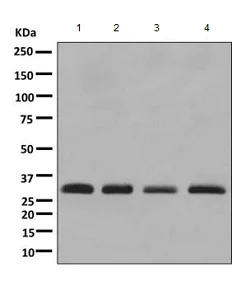 Western blot - Anti-TPMT antibody [EPR10820(B)] (AB155284)