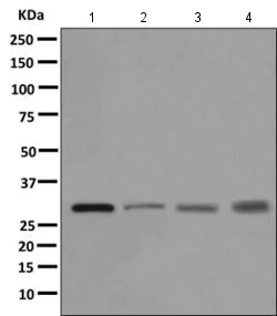Western blot - Anti-TPMT antibody [EPR10821(B)] (AB166909)
