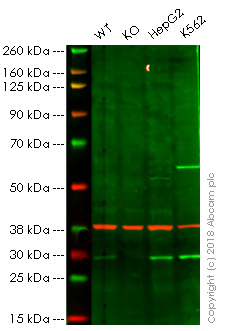Western blot - Anti-TPMT antibody [EPR10821(B)] (AB166909), expandable thumbnail
