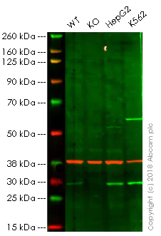 Western blot - Anti-TPMT antibody [EPR10821(B)] (AB166909)