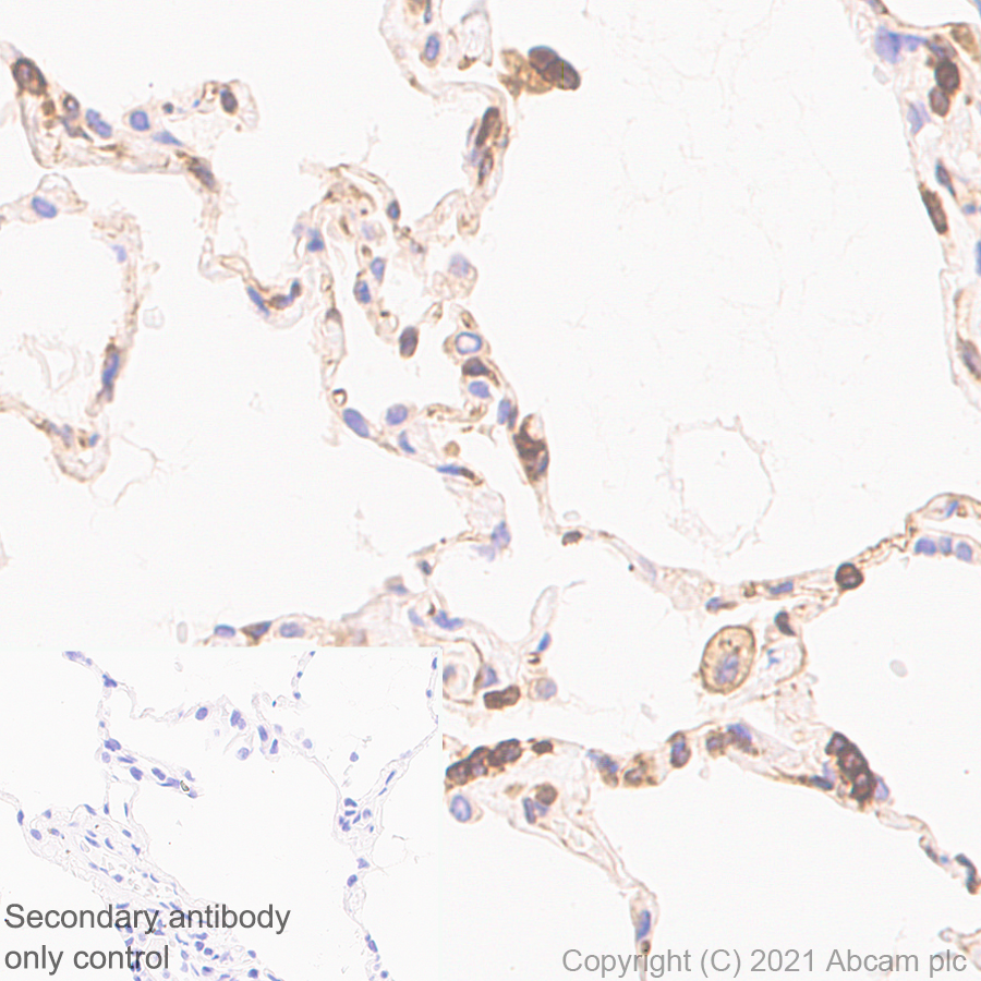 Immunohistochemistry (Formalin/PFA-fixed paraffin-embedded sections) - Anti-TPN antibody [EPR25083-20] - BSA and Azide free (AB288574), expandable thumbnail