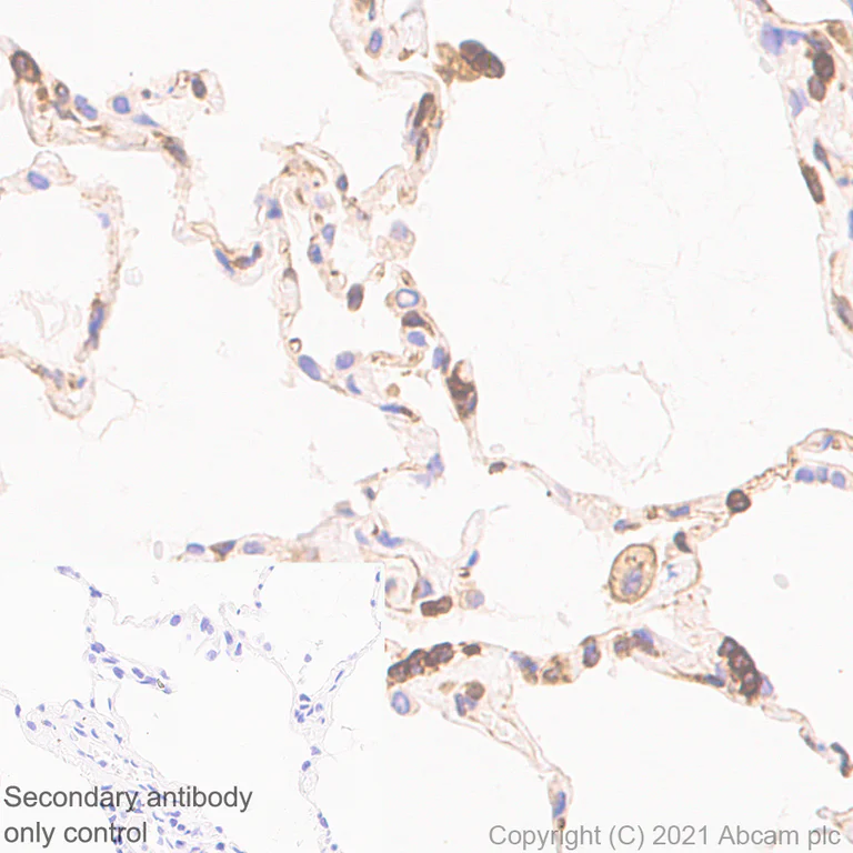 Immunohistochemistry (Formalin/PFA-fixed paraffin-embedded sections) - Anti-TPN antibody [EPR25083-20] - BSA and Azide free (AB288574)