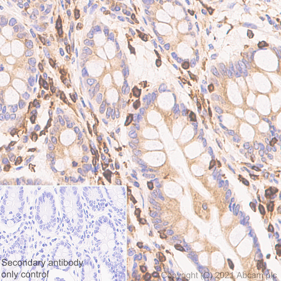 Immunohistochemistry (Formalin/PFA-fixed paraffin-embedded sections) - Anti-TPN antibody [EPR25083-20] - BSA and Azide free (AB288574), expandable thumbnail