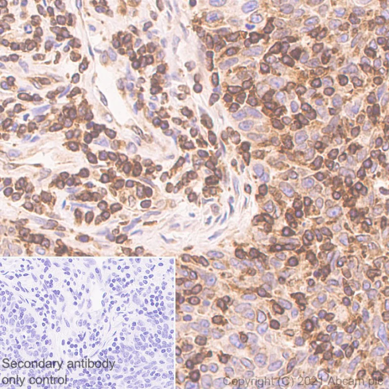 Immunohistochemistry (Formalin/PFA-fixed paraffin-embedded sections) - Anti-TPN antibody [EPR25083-20] - BSA and Azide free (AB288574)
