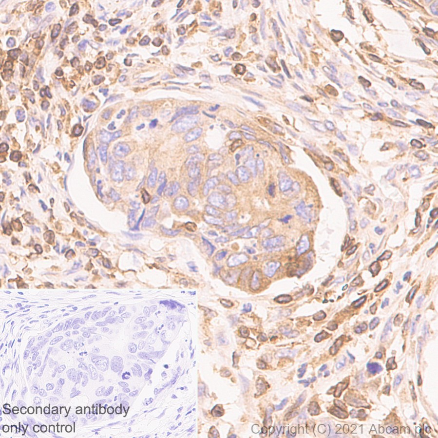 Immunohistochemistry (Formalin/PFA-fixed paraffin-embedded sections) - Anti-TPN antibody [EPR25083-20] - BSA and Azide free (ab288574), expandable thumbnail