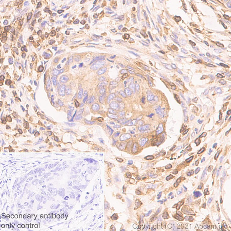 Immunohistochemistry (Formalin/PFA-fixed paraffin-embedded sections) - Anti-TPN antibody [EPR25083-20] - BSA and Azide free (AB288574)