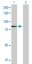 Western blot - Anti-TPOR/MPL antibody (AB172061)