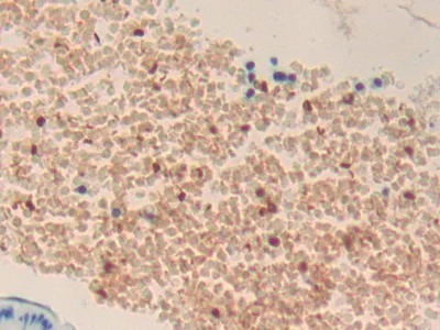 Immunohistochemistry (Formalin/PFA-fixed paraffin-embedded sections) - Anti-TPOR/MPL antibody (AB232755)