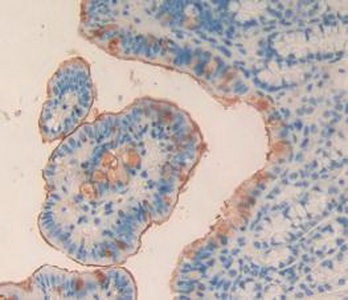 Immunohistochemistry (Formalin/PFA-fixed paraffin-embedded sections) - Anti-TPOR/MPL antibody (AB232755)