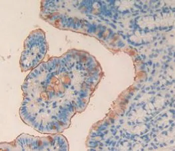 Immunohistochemistry (Formalin/PFA-fixed paraffin-embedded sections) - Anti-TPOR/MPL antibody (AB232755)