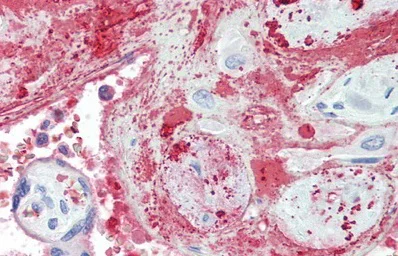 Immunohistochemistry (Formalin/PFA-fixed paraffin-embedded sections) - Anti-TPOR/MPL antibody (AB232755)