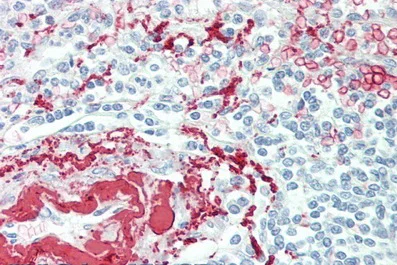 Immunohistochemistry (Formalin/PFA-fixed paraffin-embedded sections) - Anti-TPOR/MPL antibody (AB232755)