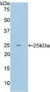 Western blot - Anti-TPOR/MPL antibody (AB232755)