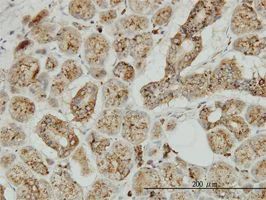 Immunohistochemistry (Formalin/PFA-fixed paraffin-embedded sections) - Anti-TPP1 antibody [3B1] (AB54685)
