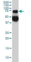 Western blot - Anti-TPP1 antibody [3B1] (AB54685)