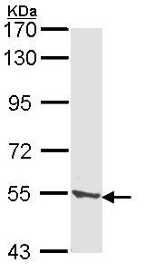 Western blot - Anti-TPP1 antibody (AB96498)