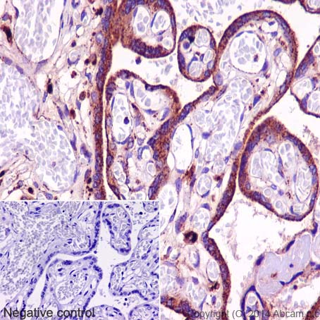 Immunohistochemistry (Formalin/PFA-fixed paraffin-embedded sections) - Anti-TPP1 antibody [EPR16537] (AB195234), expandable thumbnail